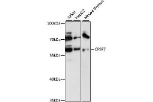 anti-Cleavage and Polyadenylation Specific Factor 7, 59kDa (CPSF7) (AA 50-240) antibody
