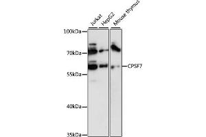 Western blot analysis of extracts of various cell lines, using CPSF7 antibody (ABIN6131022, ABIN6140675, ABIN6140676 and ABIN6218037) at 1:3000 dilution. (CPSF7 anticorps  (AA 50-240))