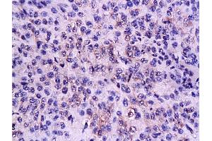Formalin-fixed and paraffin embedded mouse lymphoma tissue labeled Anti-CD3 Polyclonal Antibody, Unconjugated (ABIN672921) 1:200, followed by conjugation to the secondary antibody and DAB staining (CD3 epsilon anticorps  (AA 101-189))