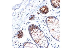Immunohistochemistry of paraffin-embedded human colon using IGFBP2 Rabbit mAb (ABIN7267907) at dilution of 1:100 (40x lens). (IGFBP2 anticorps)