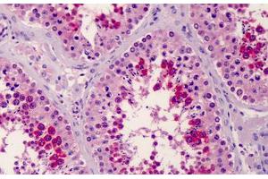 Human Testis: Formalin-Fixed, Paraffin-Embedded (FFPE)