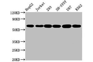 Western Blot Positive WB detected in: HepG2 whole cell lysate, Jurkat whole cell lysate, 293 whole cell lysate, SH-SY5Y whole cell lysate, U87 whole cell lysate, K562 whole cell lysate All lanes: CYP19A1 antibody at 2. (Recombinant Aromatase anticorps)
