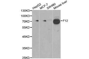 Western blot analysis of extracts of various cell lines, using F12 antibody. (F12 anticorps)