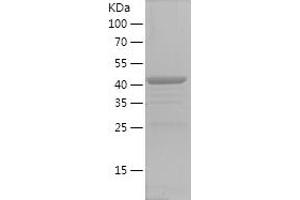Western Blotting (WB) image for ELKS/RAB6-Interacting/CAST Family Member 1 (ERC1) (AA 700-850) protein (GST tag) (ABIN7122760)