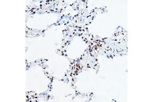 Immunohistochemistry of paraffin-embedded rat lung using YE Rabbit pAb (ABIN6130808, ABIN6150331, ABIN6150332 and ABIN6221925) at dilution of 1:100 (40x lens). (GAS41 anticorps  (AA 1-227))