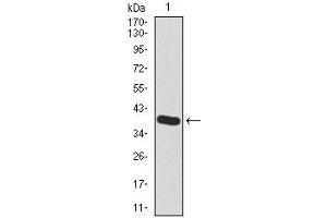 Western blot analysis using HAS2 mAb against human HAS2 recombinant protein.
