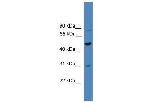WB Suggested Anti-ZNF577 Antibody Titration:  0. (ZNF577 anticorps  (C-Term))