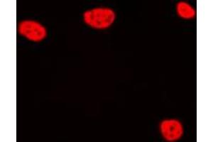 Immunofluorescent analysis of TCEB3C staining in Jurkat cells.