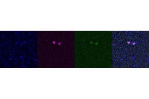 Immunohistochemistry (IHC) image for anti-SATB Homeobox 2 (SATB2) antibody (ABIN7456026)