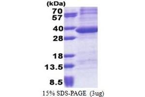 SDS-PAGE (SDS) image for Protein Phosphatase 1, Regulatory Subunit 3B (PPP1R3B) (AA 1-285) protein (His tag) (ABIN5853243)