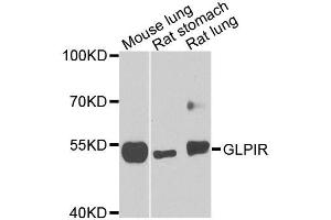 Western blot analysis of extracts of various cell lines, using GLP1R antibody (ABIN5996035) at 1/1000 dilution. (GLP1R anticorps)