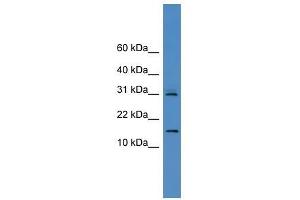 CST8 antibody used at 0. (CST8 anticorps  (N-Term))
