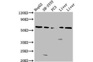 Western Blot Positive WB detected in: HepG2 whole cell lysate, SH-SY5Y whole cell lysate, PC-3 whole cell lysate, Rat liver tissue, Mouse liver tissue All lanes: UGT1A1 antibody at 4. (UGT1A1 anticorps  (AA 395-482))