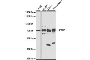 Western blot analysis of extracts of various cell lines, using SETD3 antibody. (SETD3 anticorps)