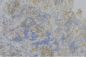 ABIN6276336 at 1/100 staining Human lymph node tissue by IHC-P. (Olfactomedin 1 anticorps)