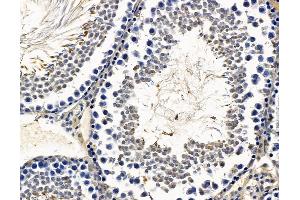 ABIN7096647 and ABIN7100712 at 1/100 staining rat testis tissue by IHC-P. (RAX anticorps)