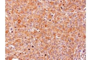 IHC-P Image Immunohistochemical analysis of paraffin-embedded H1299 xenograft, using AdoHcyase, antibody at 1:100 dilution.