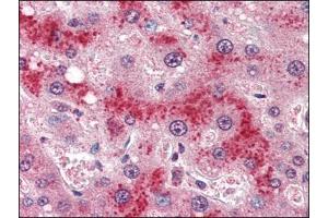 Human Liver (formalin-fixed, paraffin-embedded) stained with LEPRat 4 µg/ml followed by biotinylated anti-goat IgG secondary antibody, alkaline phosphatase-streptavidin and chromogen. (Leptin Receptor anticorps  (Internal Region))