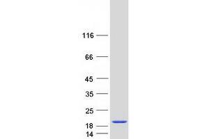 Validation with Western Blot