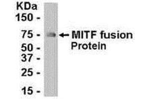 Western Blotting (WB) image for anti-Microphthalmia-Associated Transcription Factor (MITF) (AA 287-417) antibody (ABIN2467990) (MITF anticorps  (AA 287-417))