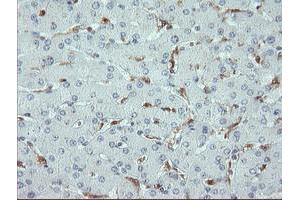 Image no. 3 for anti-PYD and CARD Domain Containing (PYCARD) antibody (ABIN1500518)