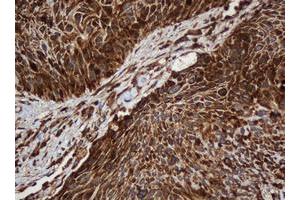 Image no. 8 for anti-SERPINE1 mRNA Binding Protein 1 (SERBP1) (AA 1-262) antibody (ABIN1490675)