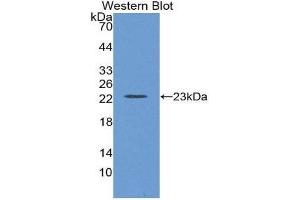 Western Blotting (WB) image for anti-Lectin, Galactoside-Binding, Soluble, 8 (LGALS8) (AA 151-316) antibody (ABIN1862521) (LGALS8 anticorps  (AA 151-316))
