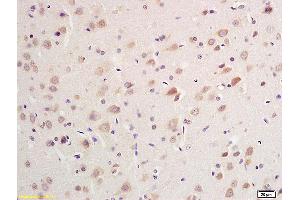 Formalin-fixed and paraffin embedded rat brain Rabbit Anti K Cadherin Polyclonal Antibody, Unconjugated (ABIN715286) at 1:200 followed by conjugation to the secondary antibody and DAB staining