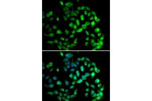 Immunofluorescence analysis of U2OS cells using GPS1 antibody. (GPS1 anticorps)
