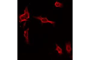 ABIN6274461 staining HepG2 by IF/ICC. (MAP4K1 anticorps  (Internal Region))