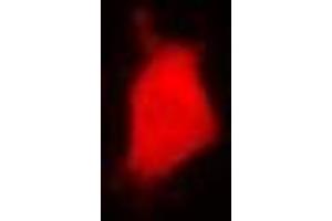 Immunofluorescent analysis of PARN staining in U2OS cells. (PARN anticorps)
