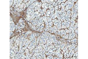 IHC analysis of FN1 using anti-FN1 antibody (ABIN7603470). (Fibronectin 1 anticorps)