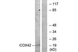 Western blot analysis of extracts from K562 cells, treated with insulin 0. (COX4I2 anticorps  (AA 31-80))