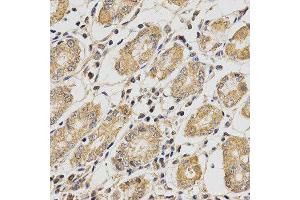 Immunohistochemistry (IHC) image for anti-Propionyl CoA Carboxylase beta Polypeptide (PCCB) antibody (ABIN1876603)