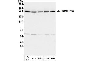 Western Blotting (WB) image for anti-Small Nuclear Ribonucleoprotein 200kDa (U5) (SNRNP200) (AA 400-450) antibody (ABIN7454918)