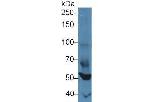 Western blot analysis of Mouse Heart lysate, using Mouse FOXP1 Antibody (3 µg/ml) and HRP-conjugated Goat Anti-Rabbit antibody ( (FOXP1 anticorps  (AA 122-346))