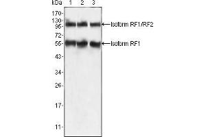 Western blot analysis using PEG10 mouse mAb against HepG2 (1), SMMC-7721 (2) and A549 (3) cell lysate.