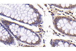 Detection of Bcl2L in Human Colon Tissue using Polyclonal Antibody to B-Cell CLL/Lymphoma 2 Like Protein (Bcl2L)