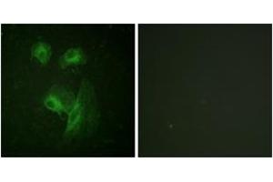 Immunofluorescence (IF) image for anti-Ribosomal Protein S6 Kinase, 70kDa, Polypeptide 1 (RPS6KB1) (AA 195-244) antibody (ABIN2888683) (RPS6KB1 anticorps  (AA 195-244))
