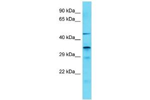 Host: Rabbit Target Name: IST1 Sample Type: COLO205 Whole Cell lysates Antibody Dilution: 1. (IST1 anticorps  (C-Term))