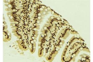 ABIN6266588 at 1/100 staining Mouse colon tissue by IHC-P. (MDM2 anticorps)