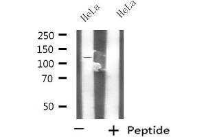 Western blot analysis of extracts from HeLa cells, using KCNH3 antibody.