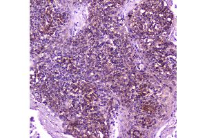 IHC analysis of PLCG 2 using anti-PLCG 2 antibody .
