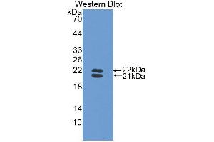 Western blot analysis of the recombinant protein. (Haptoglobin anticorps  (AA 118-281))