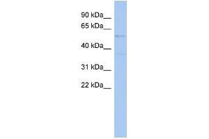 WB Suggested Anti-SMYD2 Antibody Titration:  0. (SMYD2A anticorps  (Middle Region))
