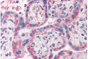 Human Placenta (formalin-fixed, paraffin-embedded) stained with PDLIM1 antibody ABIN337145 at 5 ug/ml followed by biotinylated anti-goat IgG secondary antibody ABIN481715, alkaline phosphatase-streptavidin and chromogen. (PDLIM1 anticorps  (AA 316-329))