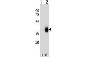 Western blot analysis of FCAR (arrow) using rabbit polyclonal FCAR Antibody (Center) . (FCAR anticorps  (Middle Region))