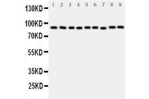 Western Blotting (WB) image for anti-Valosin Containing Protein (VCP) (AA 749-766), (C-Term) antibody (ABIN3043984) (VCP anticorps  (C-Term))