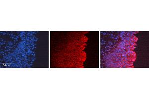 Rabbit Anti-COL1A1 Antibody Catalog Number: ARP59998_P050 Formalin Fixed Paraffin Embedded Tissue: Human Urinary Bladder Tissue Observed Staining: Cytoplasm Primary Antibody Concentration: 1:100 Other Working Concentrations: N/A Secondary Antibody: Donkey anti-Rabbit-Cy3 Secondary Antibody Concentration: 1:200 Magnification: 20X Exposure Time: 0.