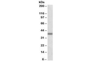 Western blot testing of human lung lysate with OXER1 antibody at 1ug/ml. (OXER1 anticorps)